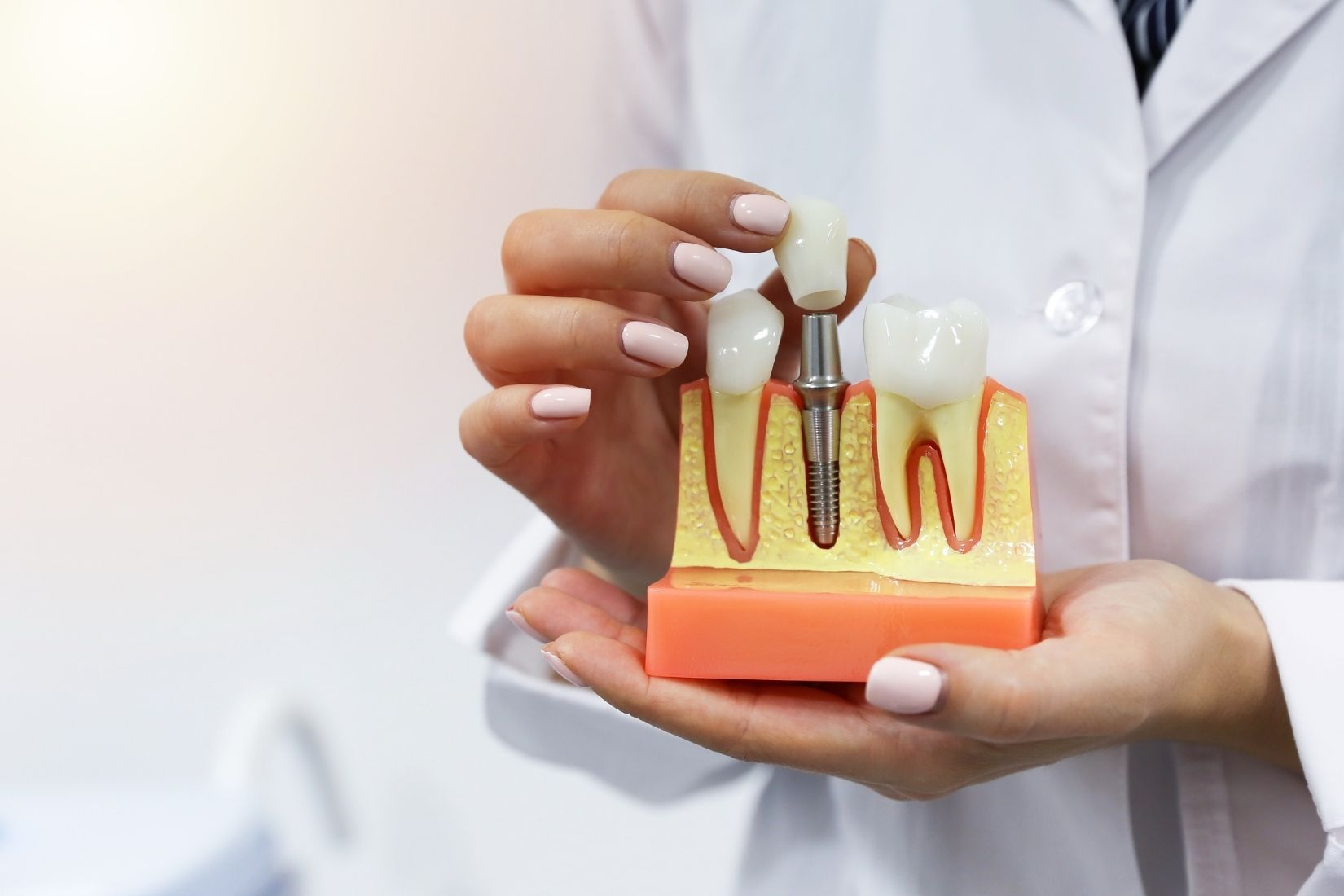 Konya implant tedavisi planlaması, çene tomografisi ve dental implant uygulamasını gösteren diş hekimliği görseli.