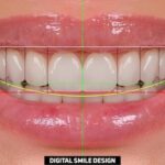 Konya ön diş estetiği planlama sürecinde gülüş tasarımı ve diş form analizini gösteren diş hekimliği görseli.