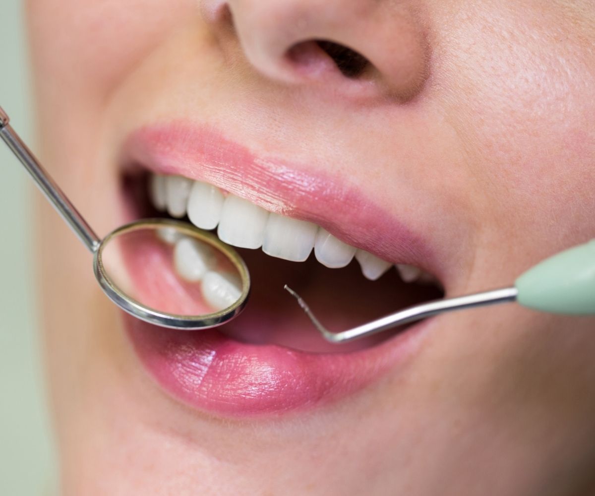 Konya bonding uygulaması öncesi ön dişlerde estetik değerlendirme