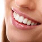 Dişlerde oluşan beyaz lekeler, mine yapısı ve diş hekimi değerlendirmesini gösteren bilgilendirici dental görsel.