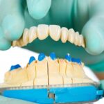 Konya porselen diş kaplama süreci, estetik kaplama planlaması ve diş hekimi muayenesini gösteren dental görsel.