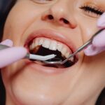 Diş eti seviyesi, gülüş estetiği ve sağlıklı diş eti görünümünü gösteren bilgilendirici dental görsel.