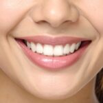 Gummy smile görünümü, diş eti seviyesi ve gülüş estetiği değerlendirmesini gösteren bilgilendirici dental görsel.