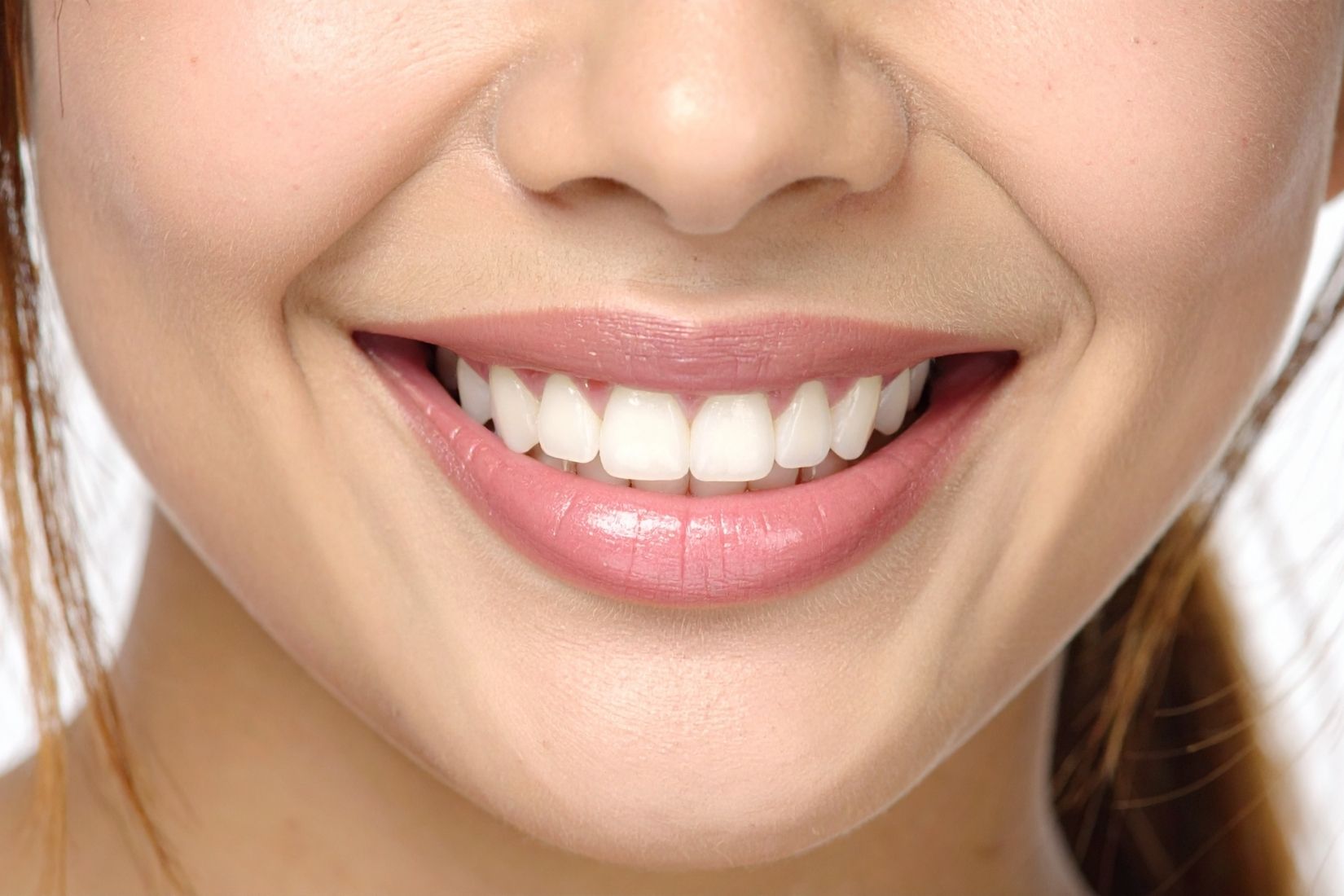 Gummy smile görünümü, diş eti seviyesi ve gülüş estetiği değerlendirmesini gösteren bilgilendirici dental görsel.