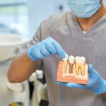 İmplant çevresinde diş eti çekilmesi, kemik seviyesi ve implant üstü protez ilişkisini gösteren bilgilendirici dental görsel.