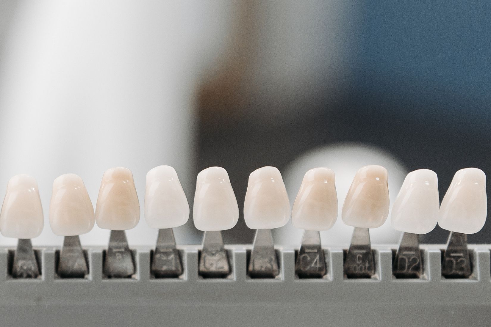 Konya’da porselen lamina planlaması, renk seçimi ve dijital ölçü aşamalarını gösteren bilgilendirici dental görsel.