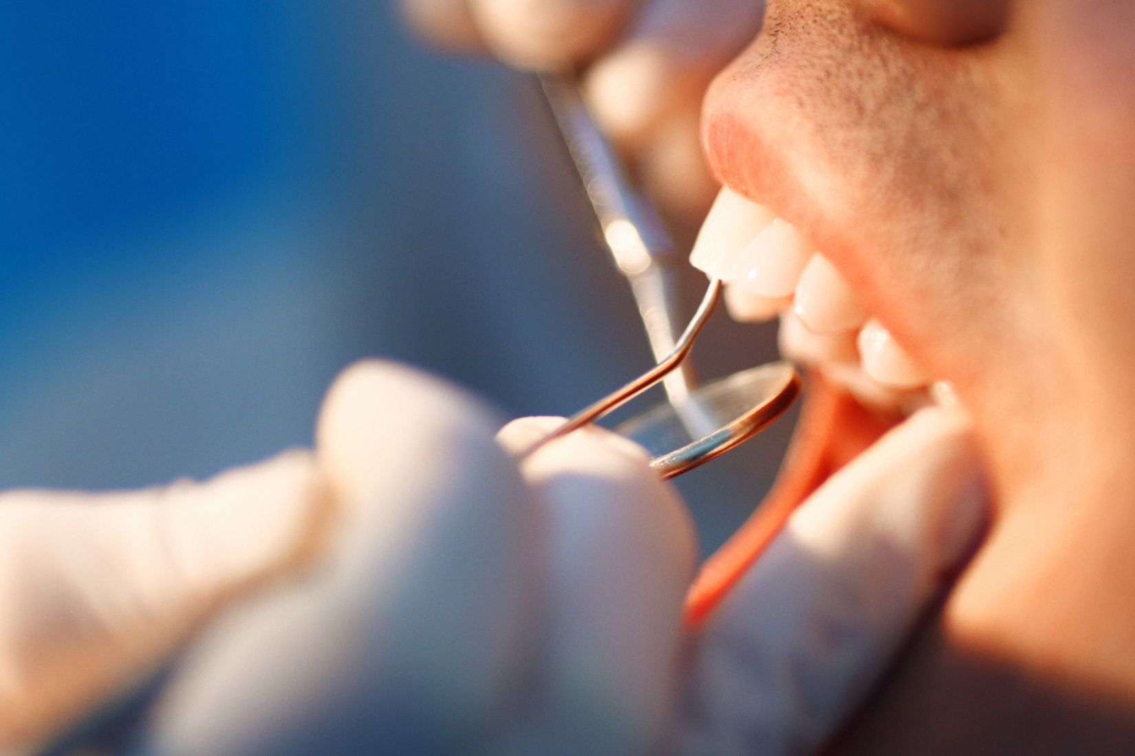 Yaz sıcaklarında ağız kuruluğu, su tüketimi ve tükürük azalmasının ağız sağlığına etkisini gösteren bilgilendirici dental görsel.