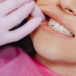 Diş sıkma ve gıcırdatmanın diş aşınması, çatlaklar ve çene kasları üzerindeki etkilerini gösteren dental görsel.