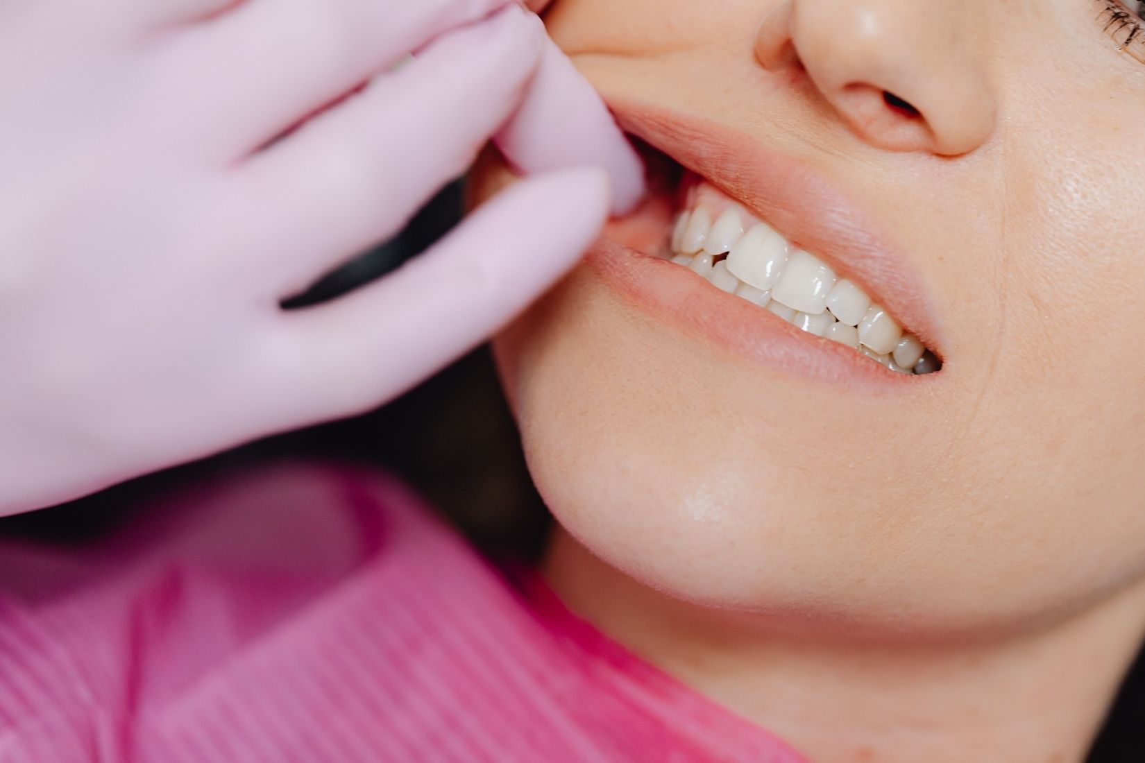 Diş sıkma ve gıcırdatmanın diş aşınması, çatlaklar ve çene kasları üzerindeki etkilerini gösteren dental görsel.