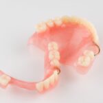 Kancalı hareketli bölümlü protezin doğal destek dişlere kroşelerle tutunmasını gösteren bilgilendirici dental görsel.