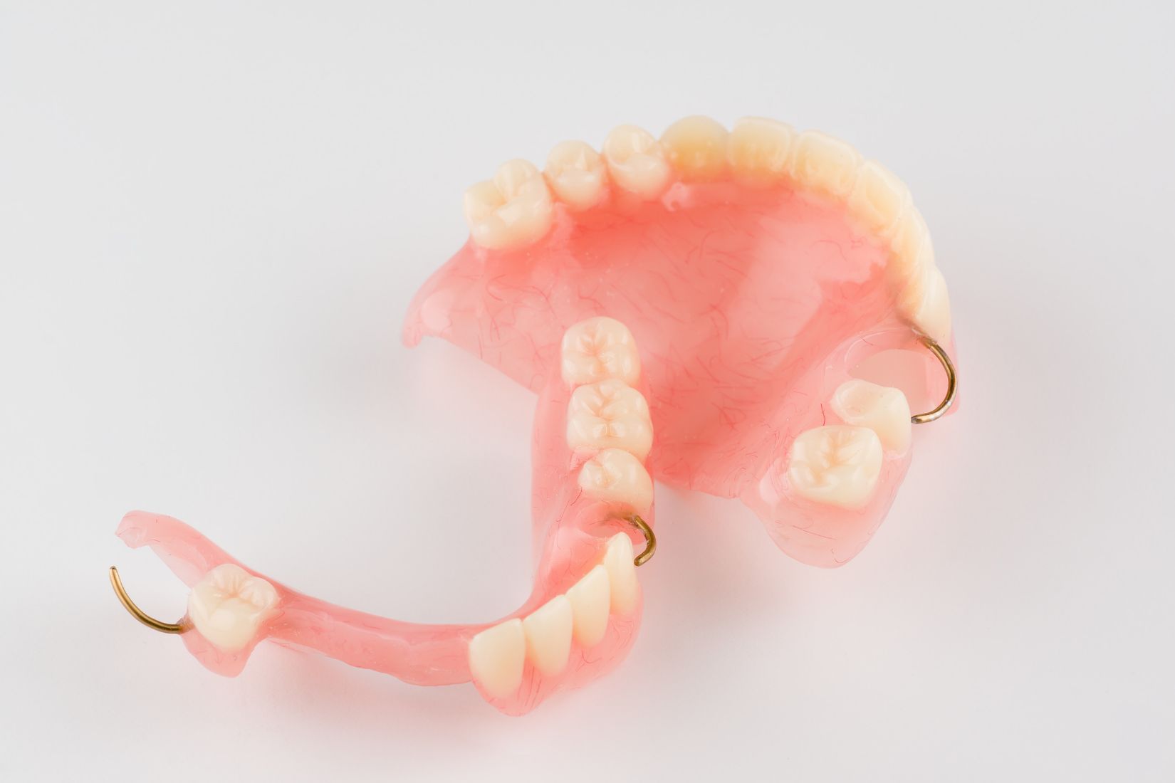 Kancalı hareketli bölümlü protezin doğal destek dişlere kroşelerle tutunmasını gösteren bilgilendirici dental görsel.
