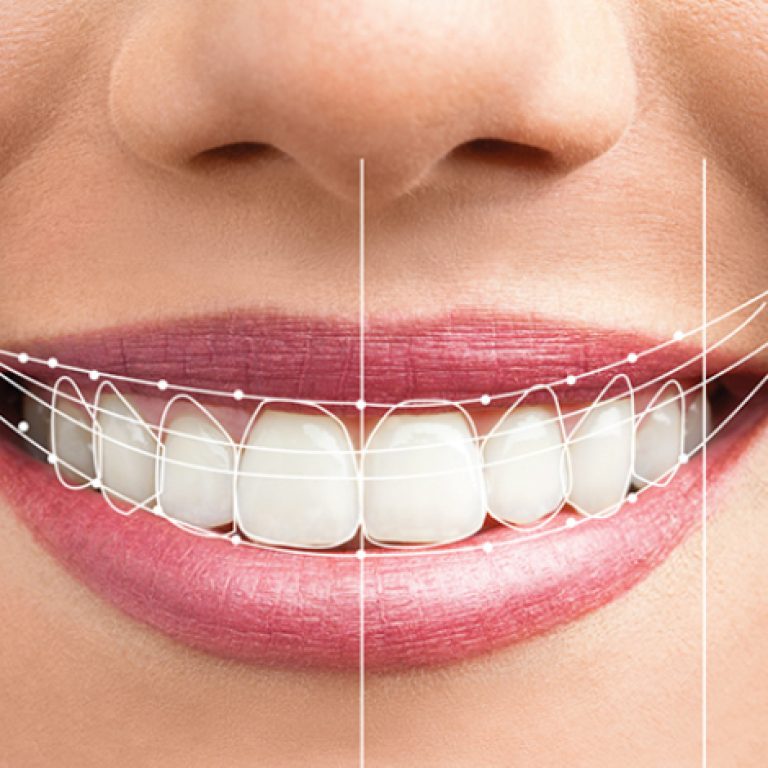 Dijital gülüş tasarımı sürecinde diş ve yüz oranlarının bilgisayar ortamında analiz edilmesini gösteren görsel