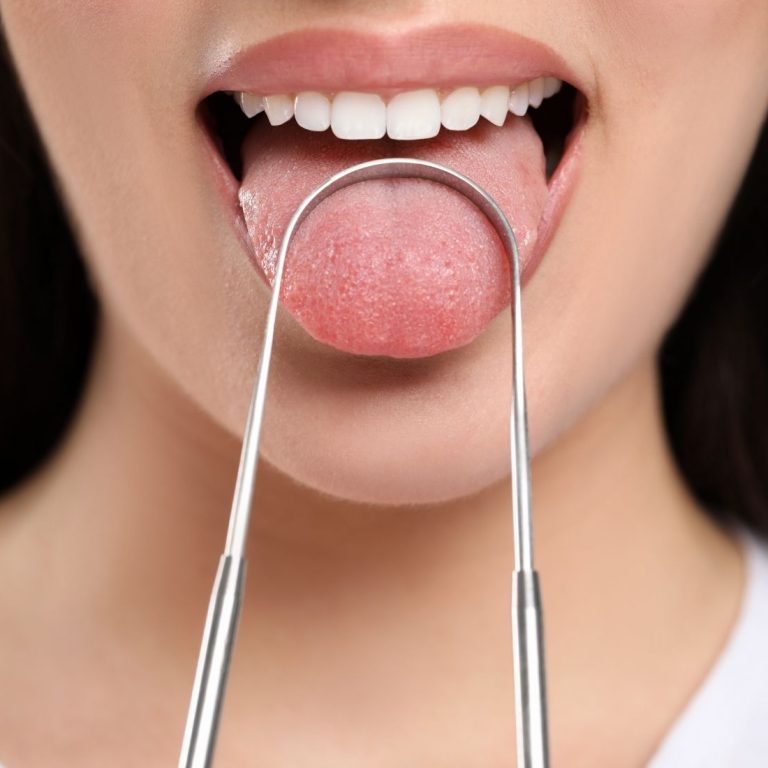 Dil üzerindeki farklı renk değişikliklerini ve ağız muayenesini gösteren bilgilendirici dental görsel.