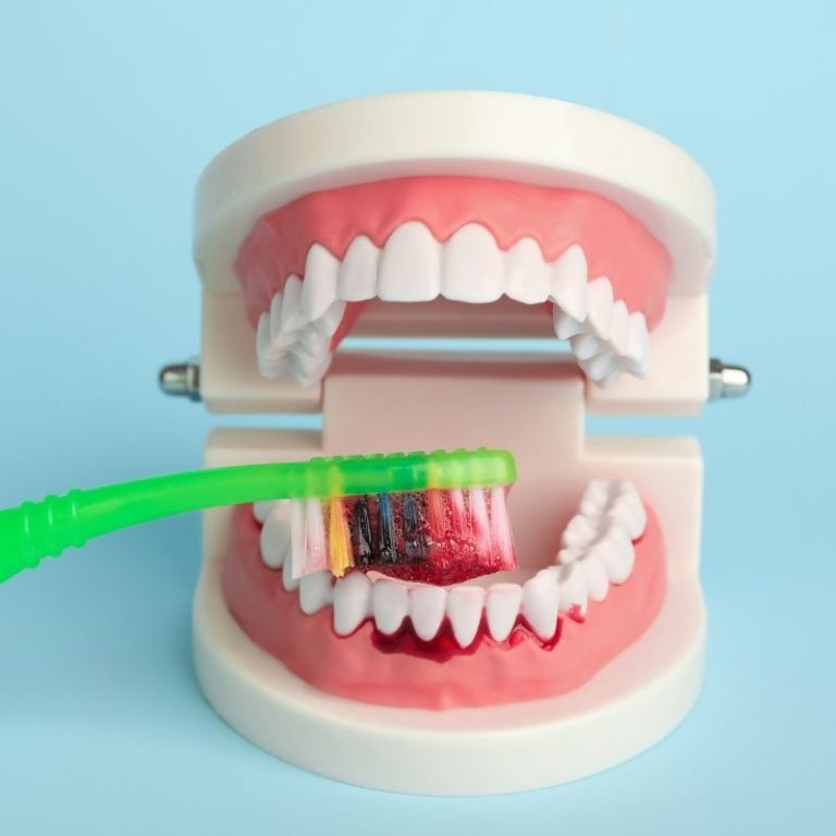 Diş eti kanamasının nedenlerini ve periodontal değerlendirme sürecini gösteren bilgilendirici diş hekimliği görseli.