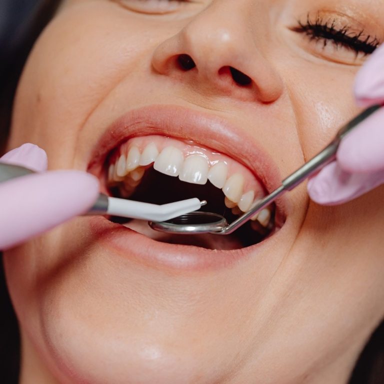 Diş eti seviyesi, gülüş estetiği ve sağlıklı diş eti görünümünü gösteren bilgilendirici dental görsel.