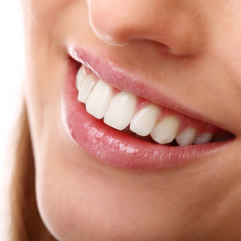 Dişlerde oluşan beyaz lekeler, mine yapısı ve diş hekimi değerlendirmesini gösteren bilgilendirici dental görsel.
