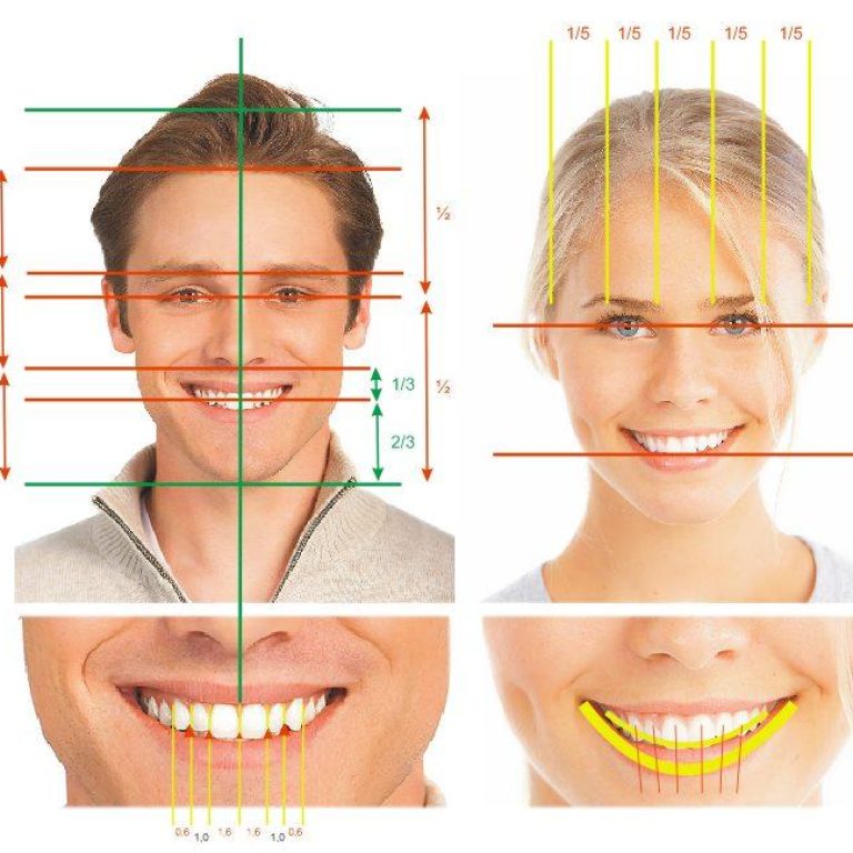 Estetik diş hekimliği uygulamaları, gülüş tasarımı ve diş beyazlatma sürecini gösteren diş hekimliği görseli.