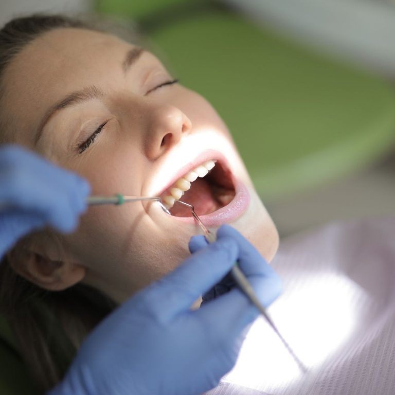 Kemik kaybına bağlı diş sallanması, diş eti çekilmesi ve periodontal destek dokularını gösteren dental görsel.