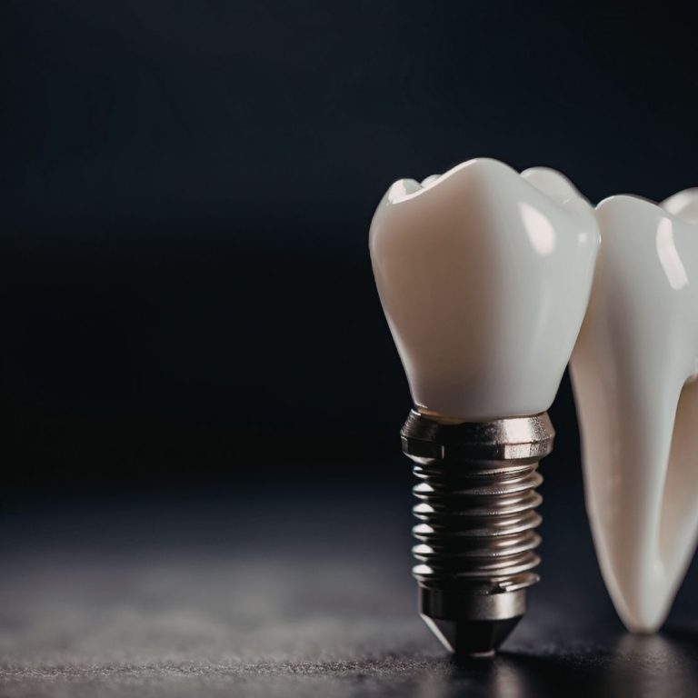 Dental implant planlamasında çene kemiği yoğunluğunu ve üç boyutlu kemik değerlendirmesini gösteren bilgilendirici görsel.