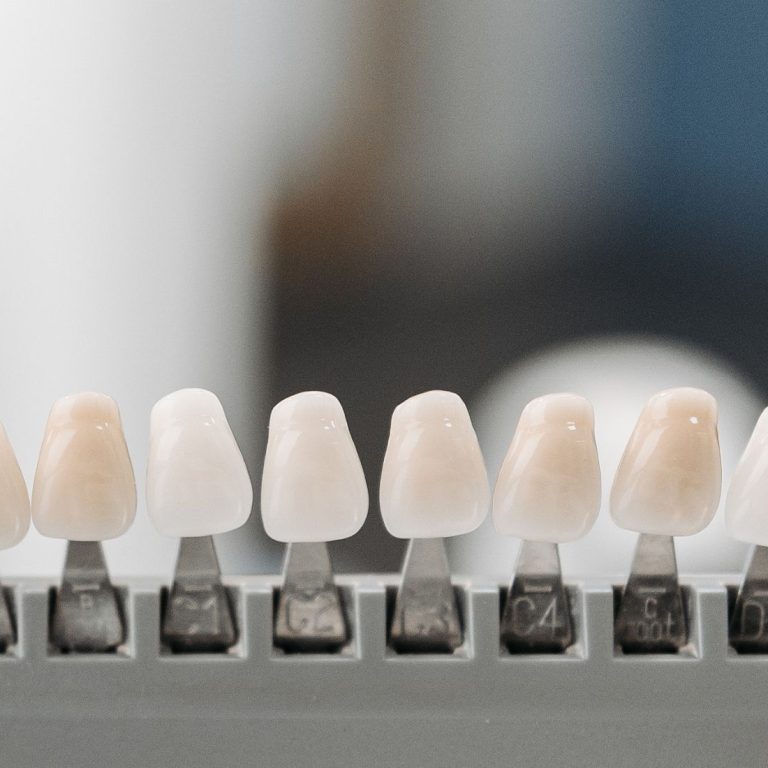 Konya’da porselen lamina planlaması, renk seçimi ve dijital ölçü aşamalarını gösteren bilgilendirici dental görsel.